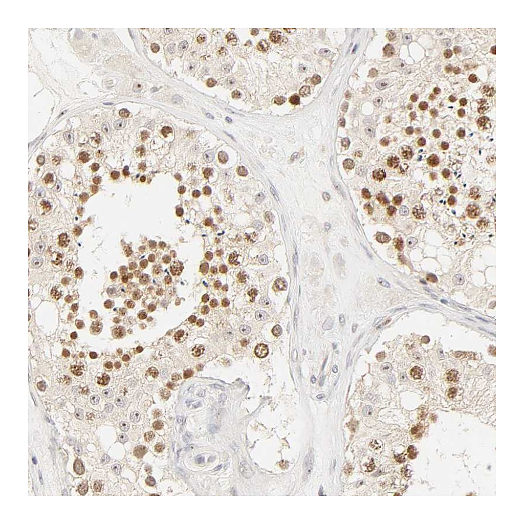 Atlas Antibodies Anti-KIF2A Antibody