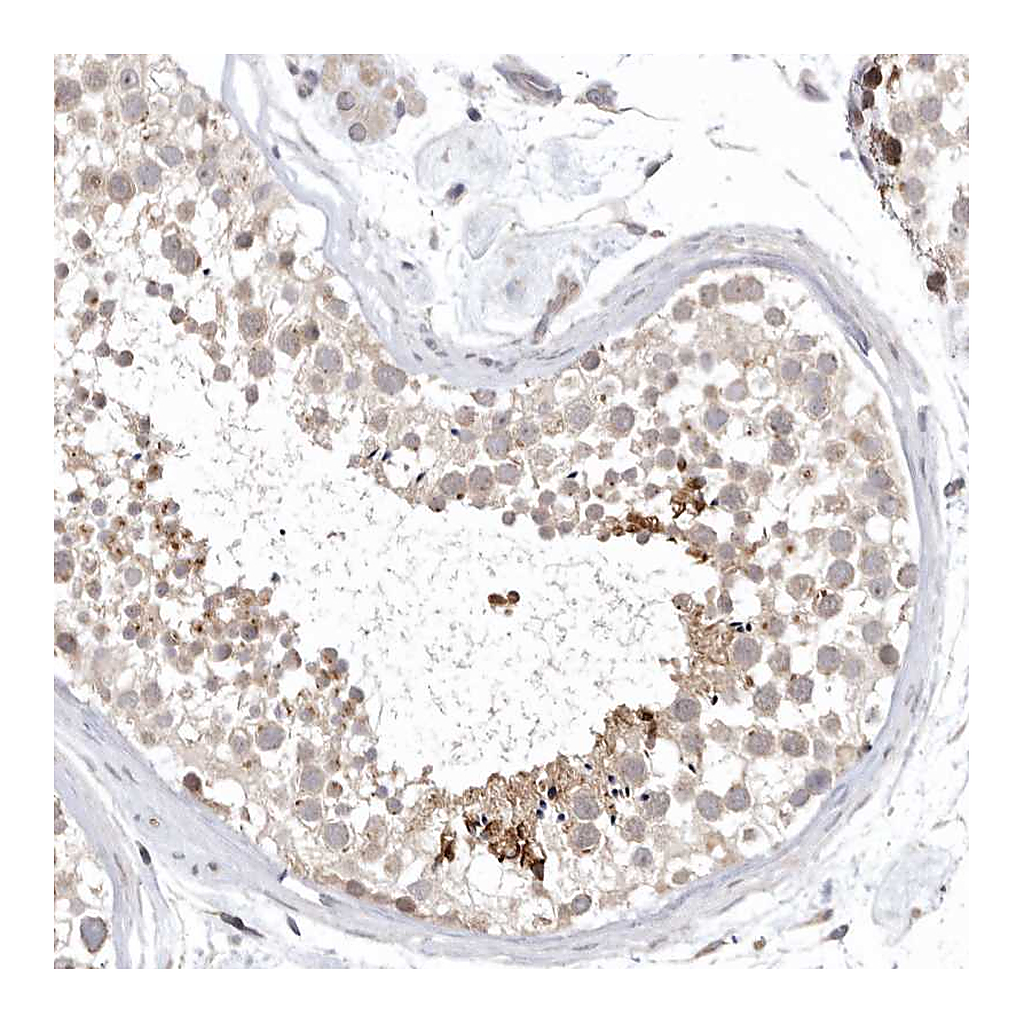 Atlas Antibodies Anti-KIF2B Antibody