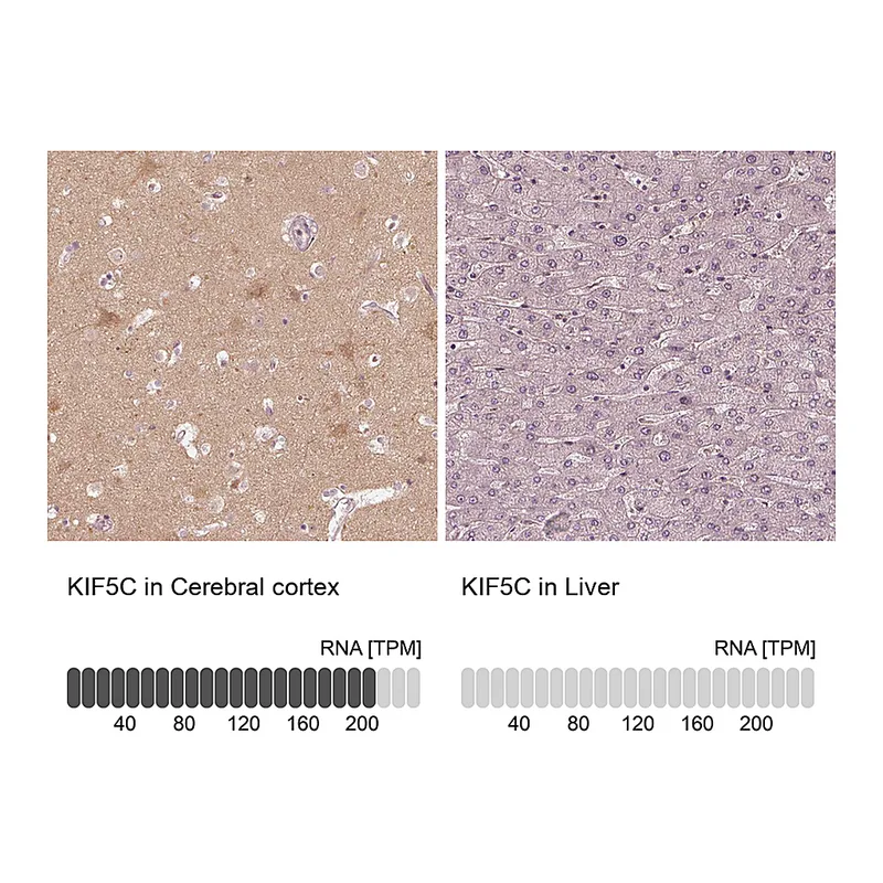 Atlas Antibodies Anti-KIF5C Antibody