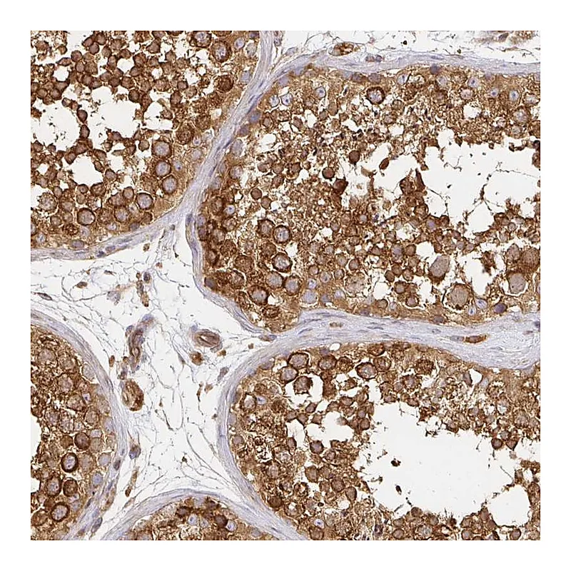 Atlas Antibodies Anti-KIF5B Antibody