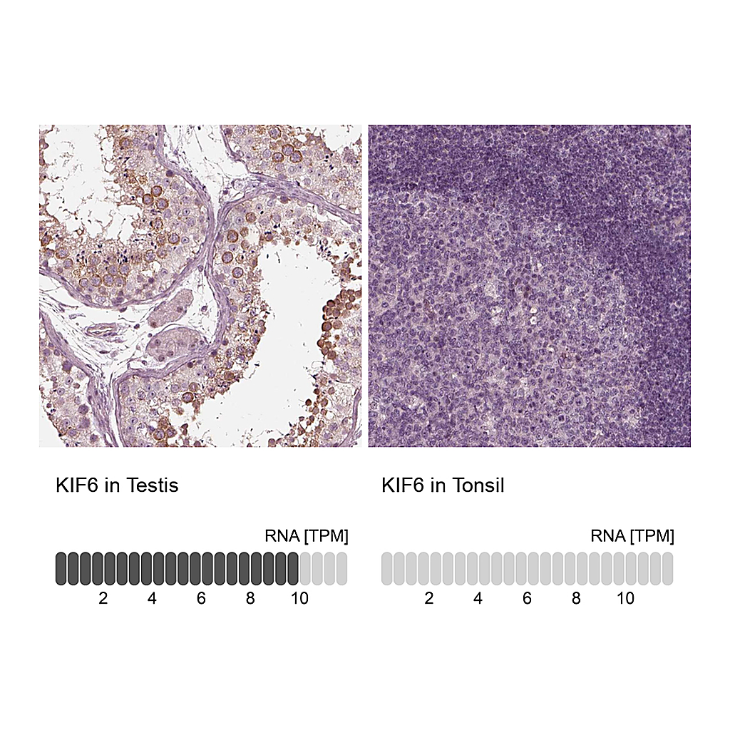 Atlas Antibodies Anti-KIF6 Antibody