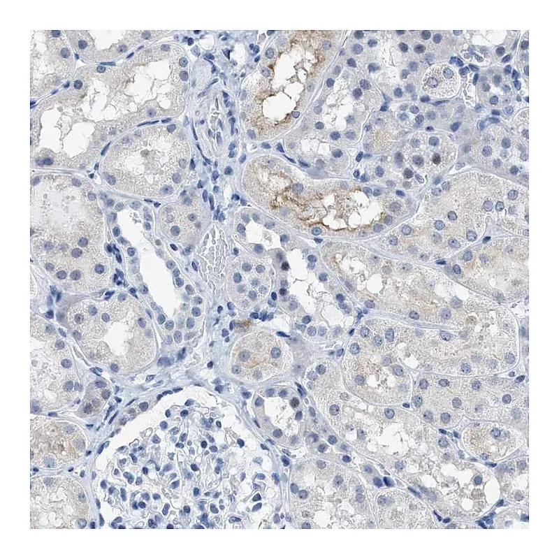 Atlas Antibodies Anti-KIFC3 Antibody