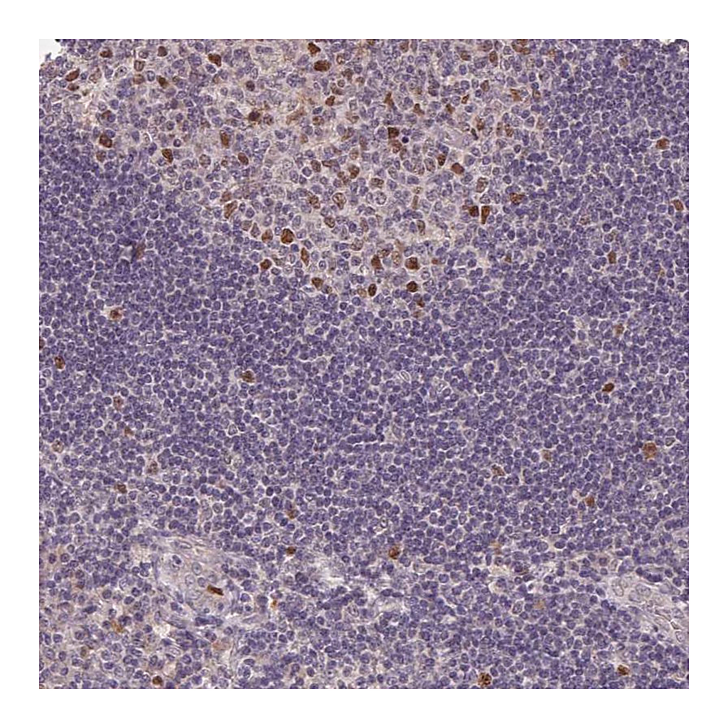 Atlas Antibodies Anti-KIFC1 Antibody