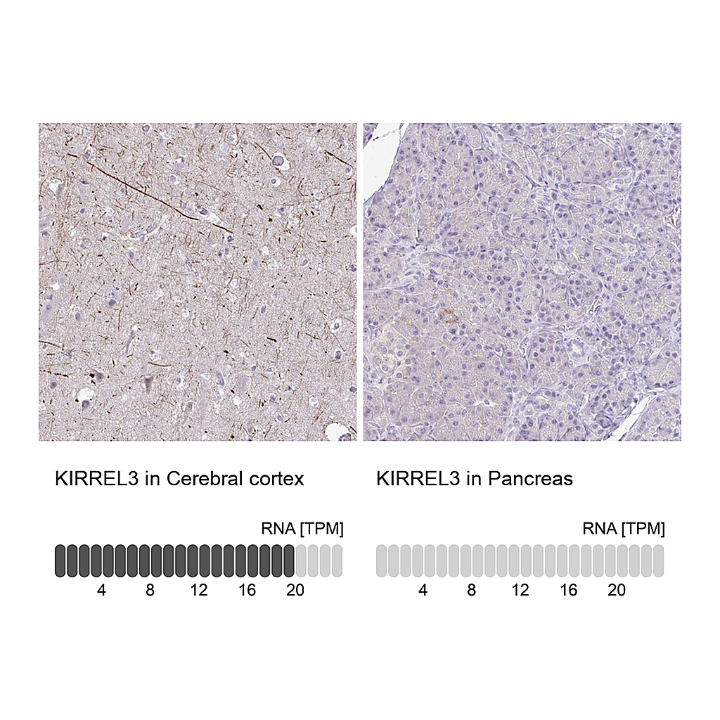 Atlas Antibodies Anti-KIRREL3 Antibody