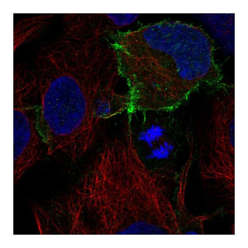 Atlas Antibodies Anti-KIT Antibody