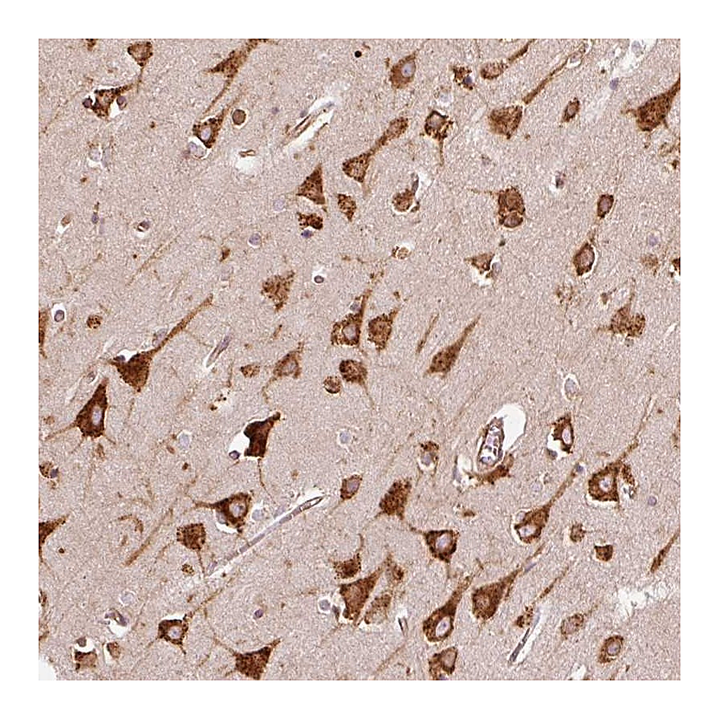 Atlas Antibodies Anti-KLC1 Antibody