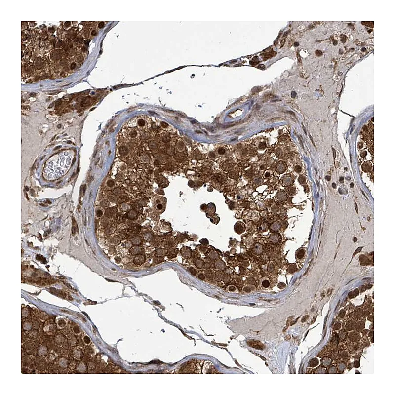 Atlas Antibodies Anti-KLC1 Antibody