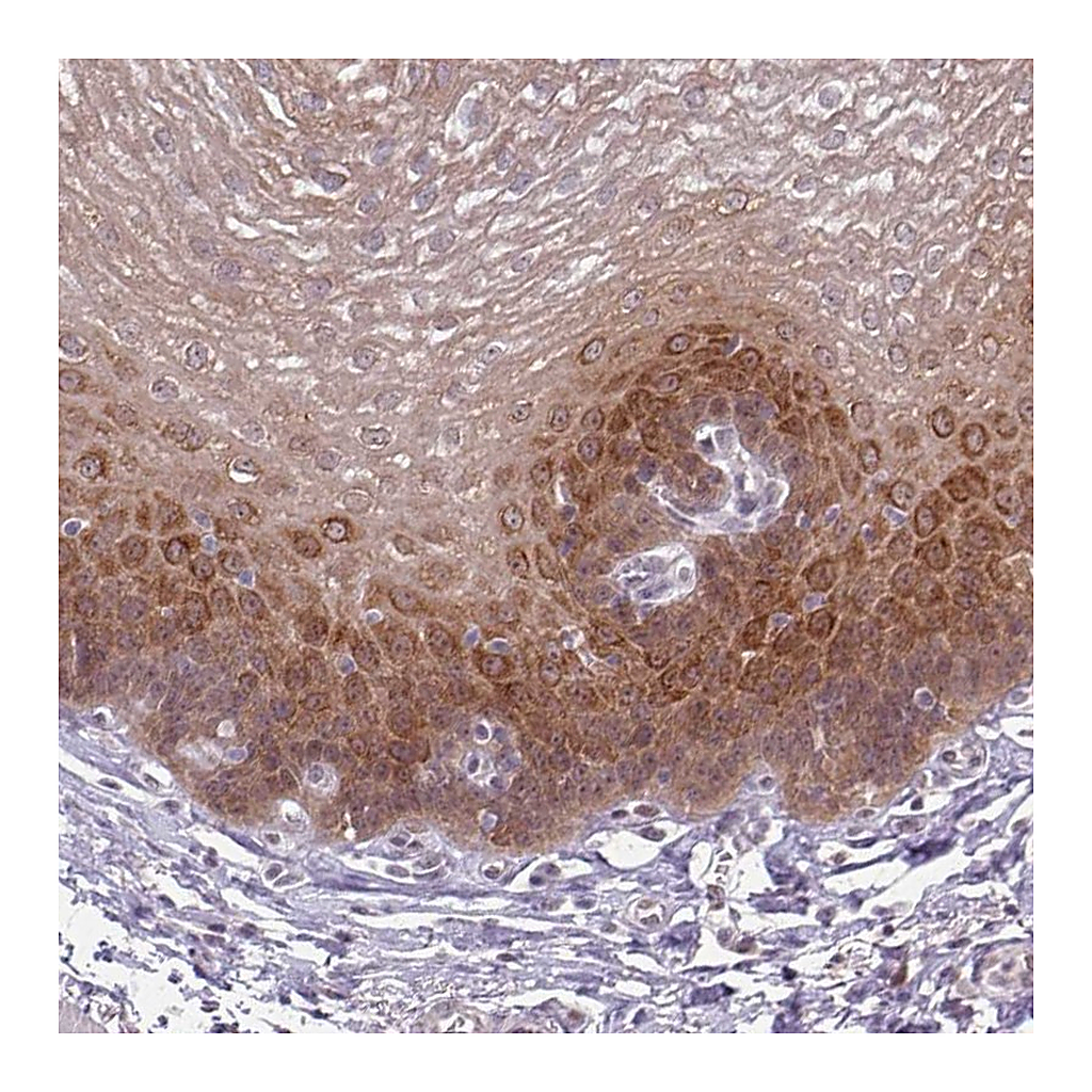 Atlas Antibodies Anti-KLC3 Antibody
