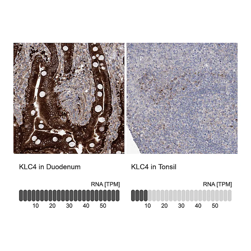 Atlas Antibodies Anti-KLC4 Antibody