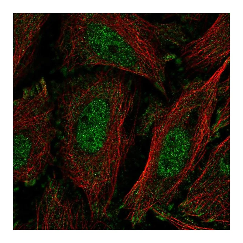 Atlas Antibodies Anti-KLF11 Antibody