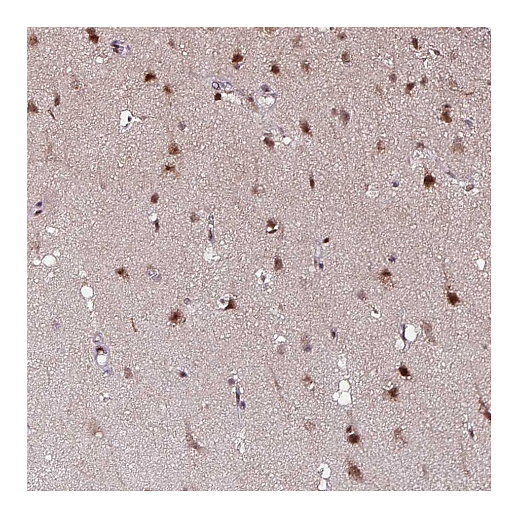 Atlas Antibodies Anti-KLF16 Antibody