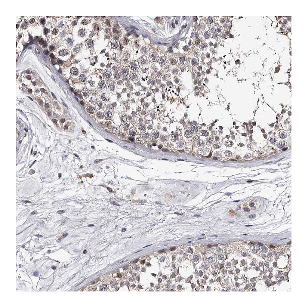 Atlas Antibodies Anti-KLHDC3 Antibody
