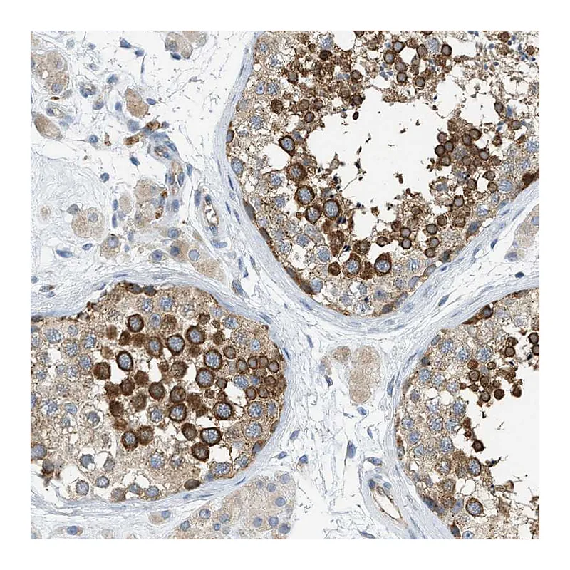 Atlas Antibodies Anti-KLHDC10 Antibody