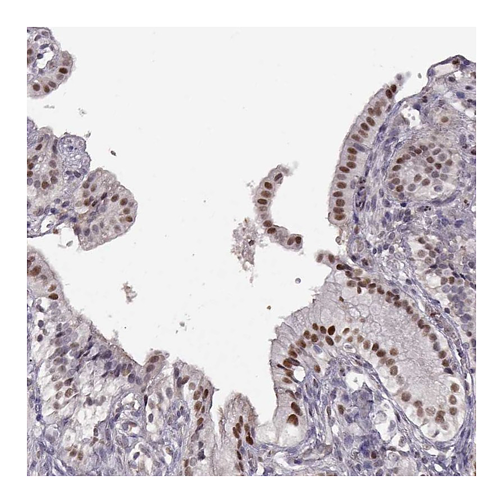 Atlas Antibodies Anti-KLF6 Antibody