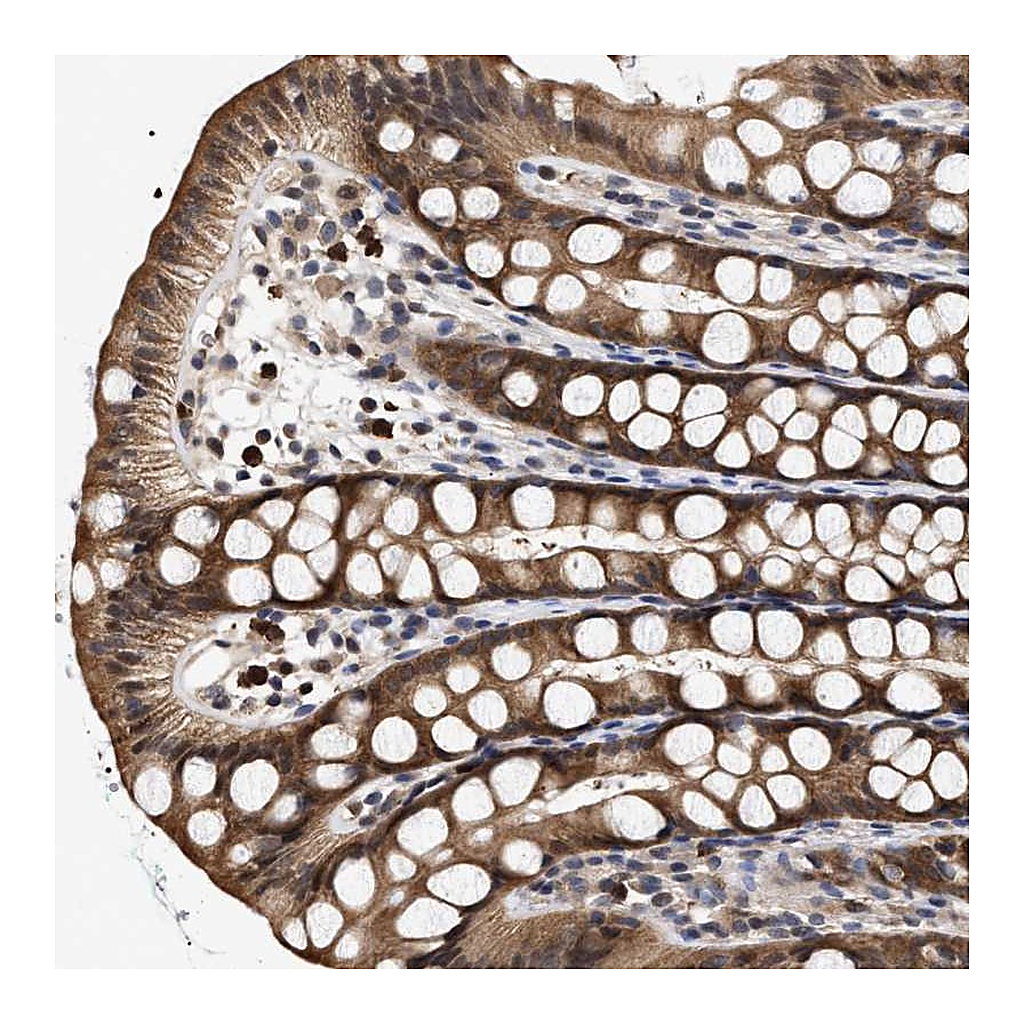 Atlas Antibodies Anti-KLHDC1 Antibody