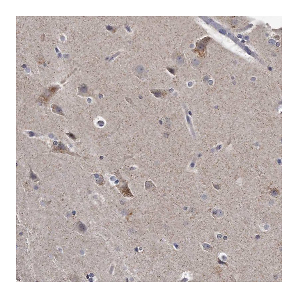 Atlas Antibodies Anti-KLHDC3 Antibody