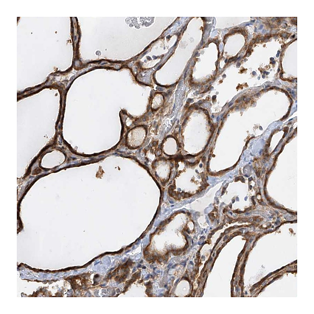 Atlas Antibodies Anti-KLHDC9 Antibody