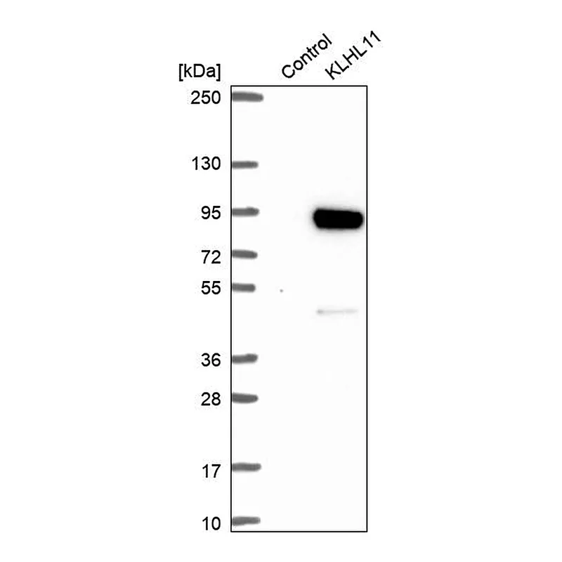 Atlas Antibodies Anti-KLHL11 Antibody