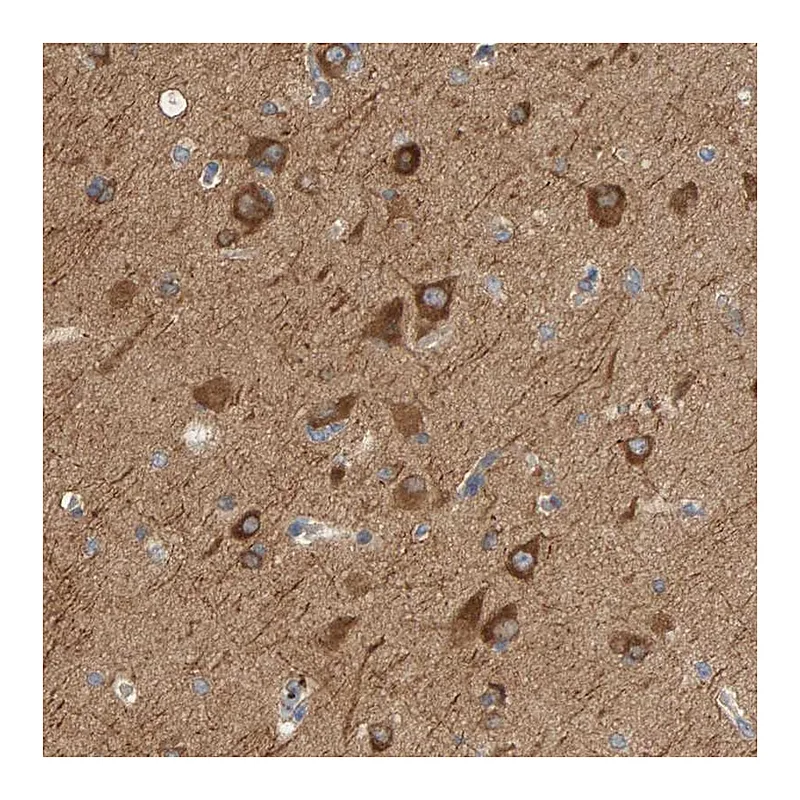 Atlas Antibodies Anti-KLHL11 Antibody