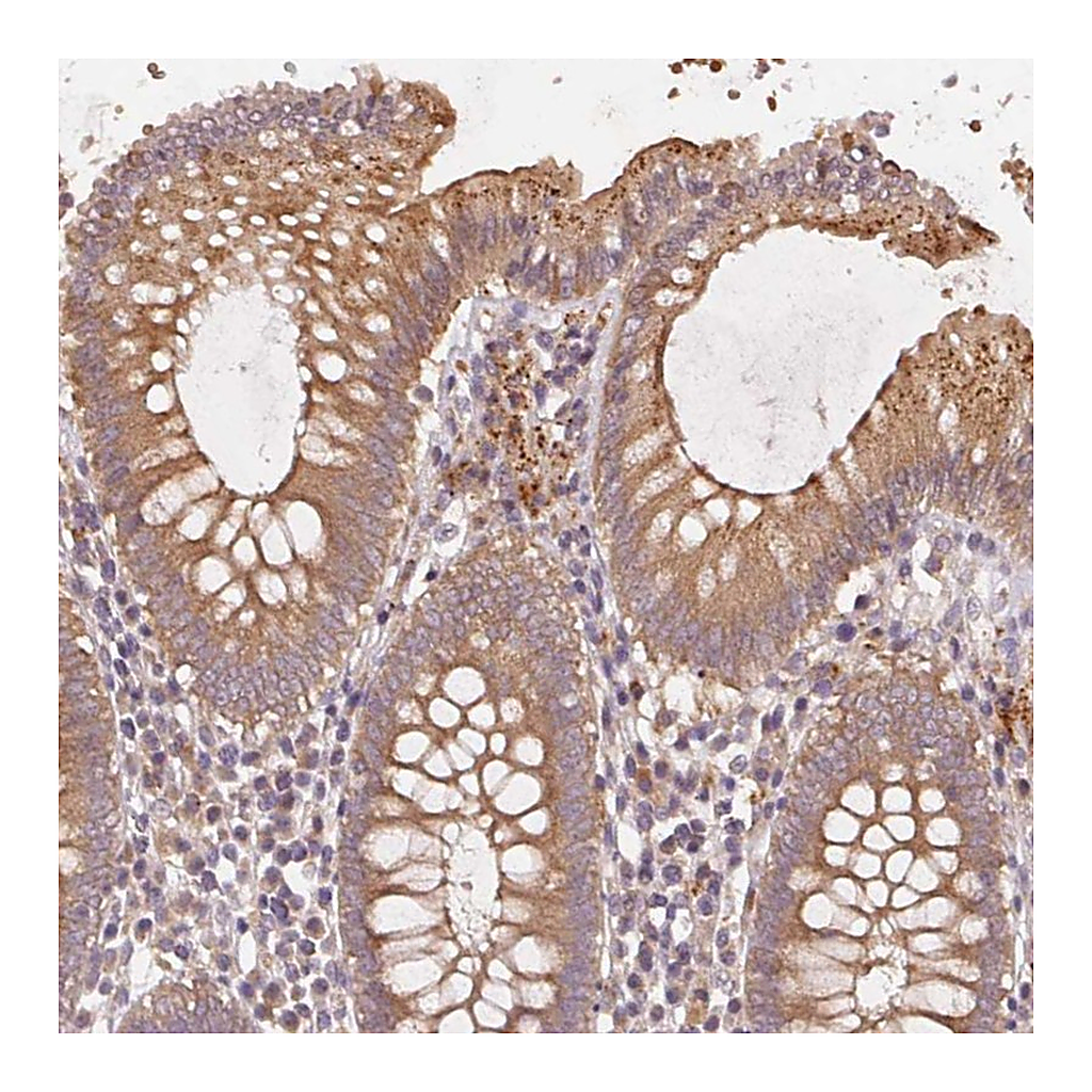 Atlas Antibodies Anti-KLHL15 Antibody