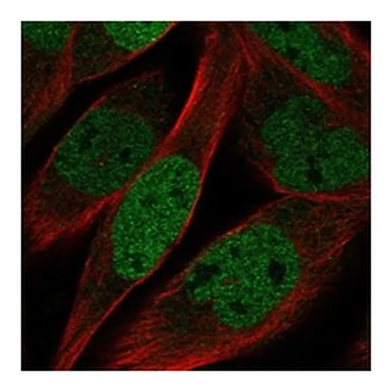 Atlas Antibodies Anti-KLHL11 Antibody