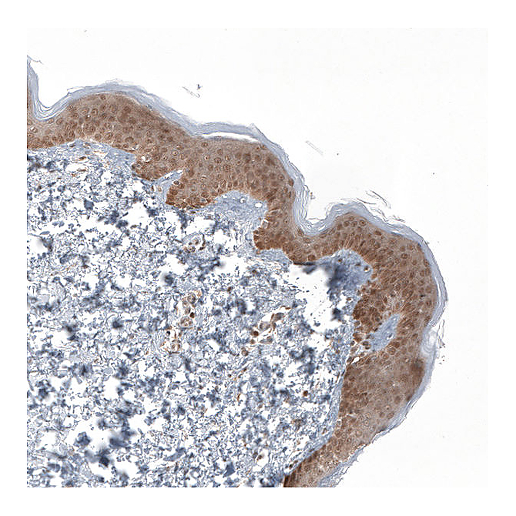Atlas Antibodies Anti-KLHL24 Antibody