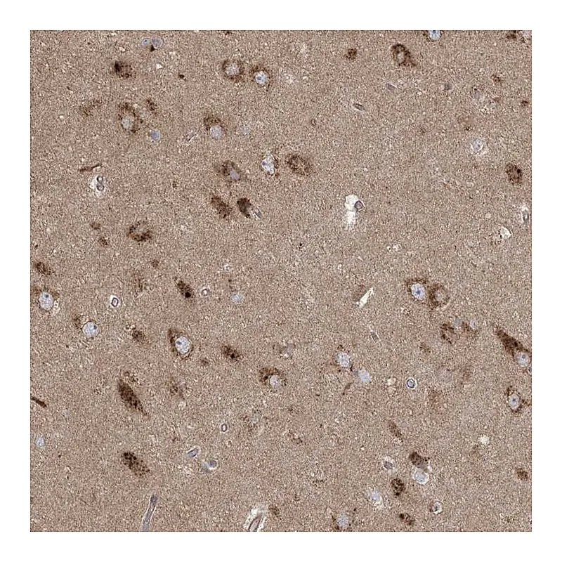 Atlas Antibodies Anti-KLHL18 Antibody