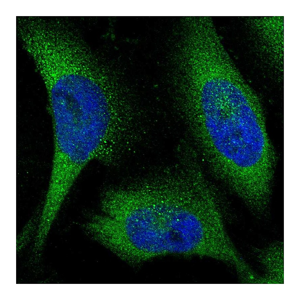 Atlas Antibodies Anti-KLHL28 Antibody