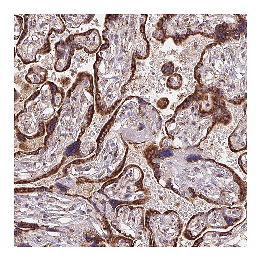 Atlas Antibodies Anti-KLHL20 Antibody