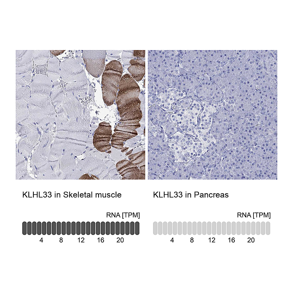 Atlas Antibodies Anti-KLHL33 Antibody