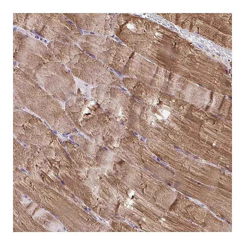 Atlas Antibodies Anti-KLHL34 Antibody