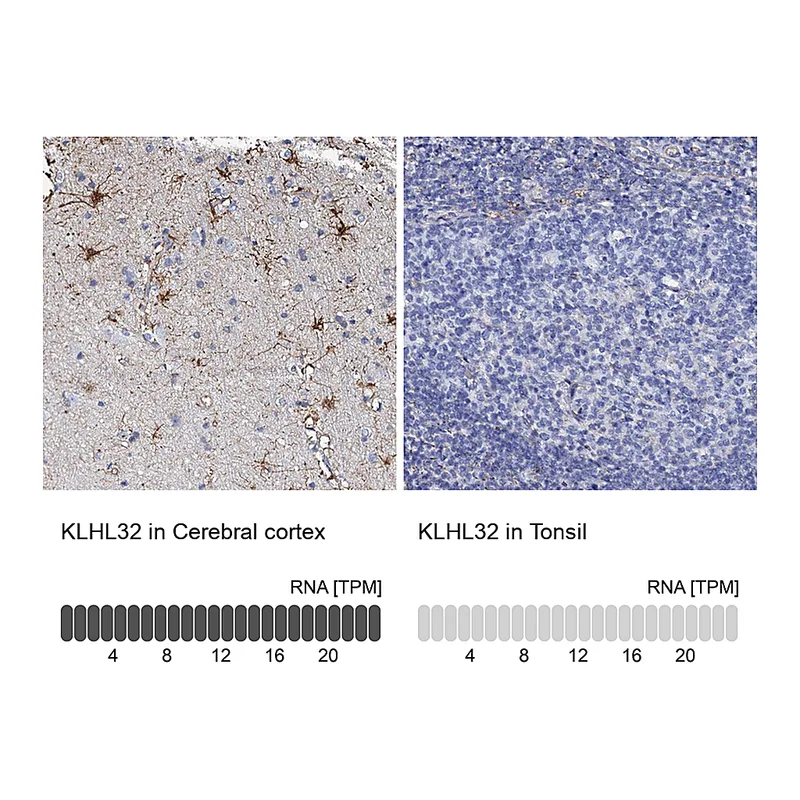 Atlas Antibodies Anti-KLHL32 Antibody