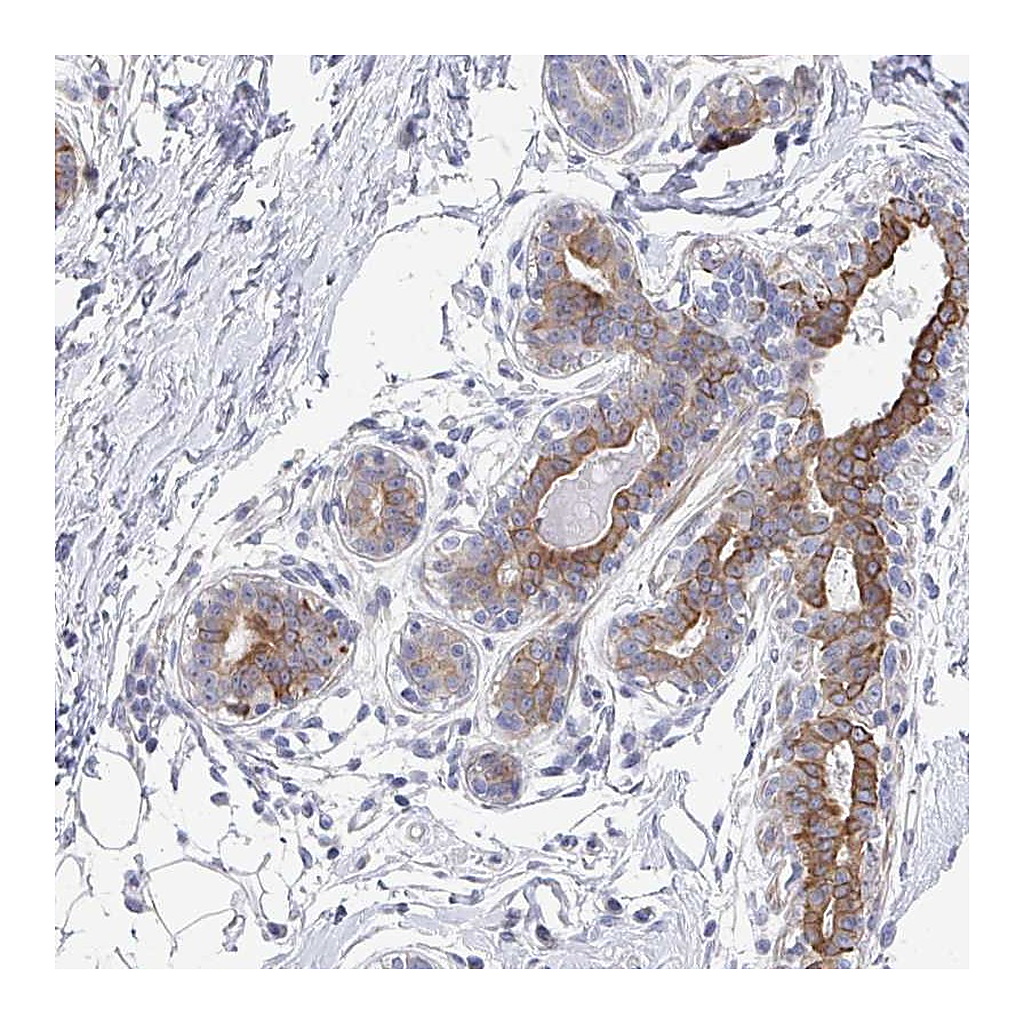 Atlas Antibodies Anti-KLHL33 Antibody