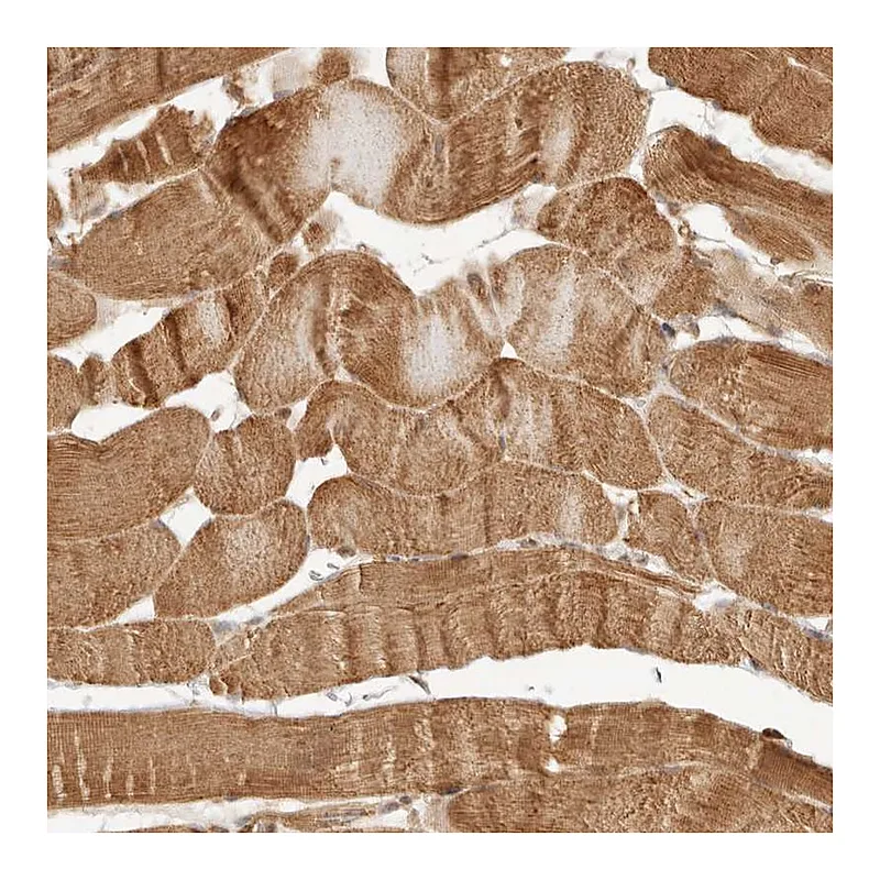 Atlas Antibodies Anti-KLHL38 Antibody
