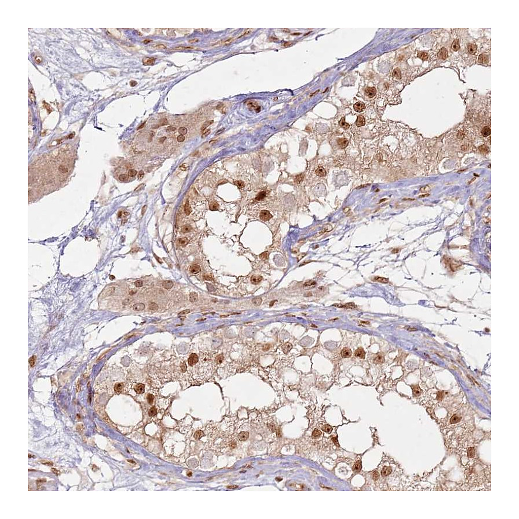 Atlas Antibodies Anti-KLHL36 Antibody
