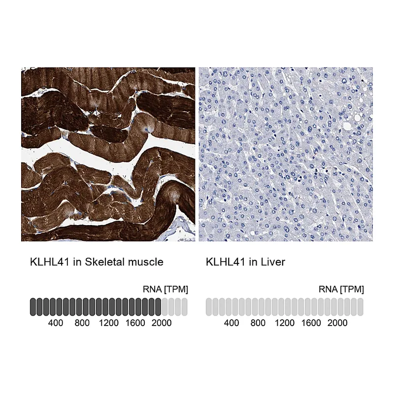 Atlas Antibodies Anti-KLHL41 Antibody