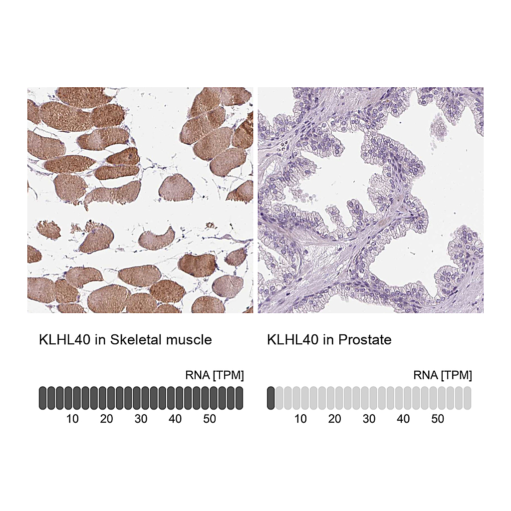 Atlas Antibodies Anti-KLHL40 Antibody