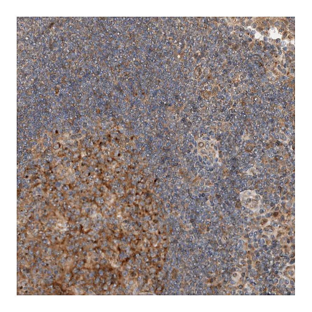 Atlas Antibodies Anti-KLHL6 Antibody