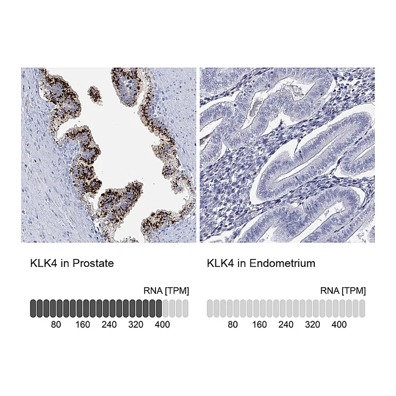 Atlas Antibodies Anti-KLK4 Antibody