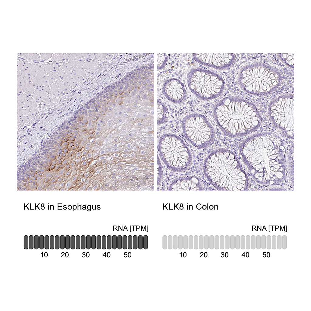 Atlas Antibodies Anti-KLK8 Antibody
