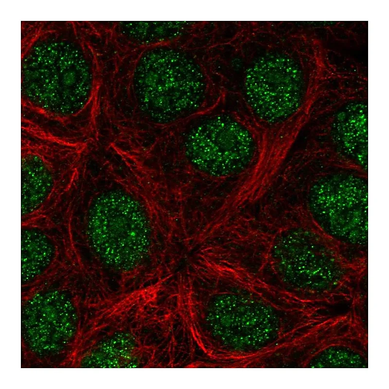 Atlas Antibodies Anti-KLLN Antibody