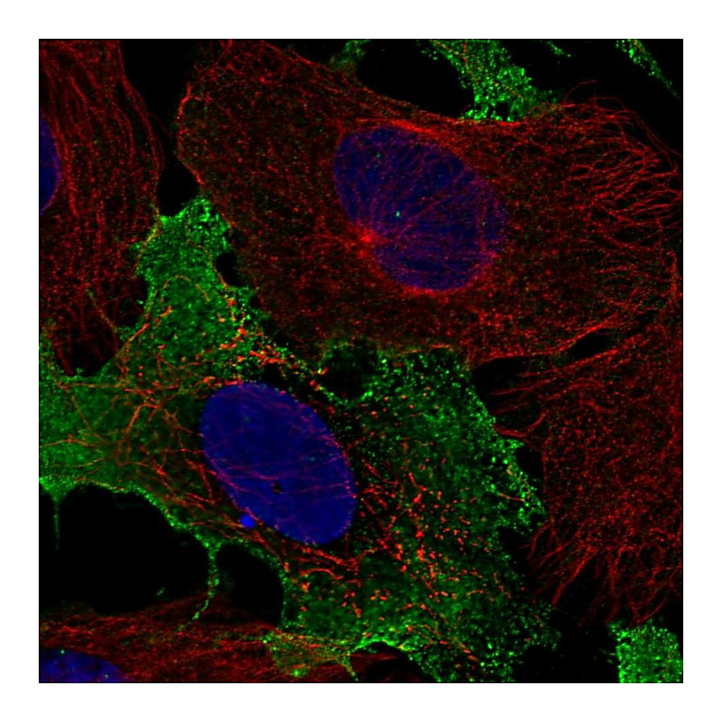Atlas Antibodies Anti-KLRC2 Antibody