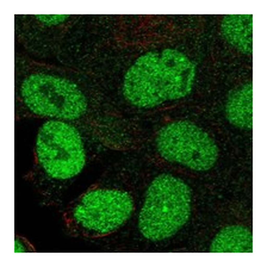 Atlas Antibodies Anti-KMT2E Antibody