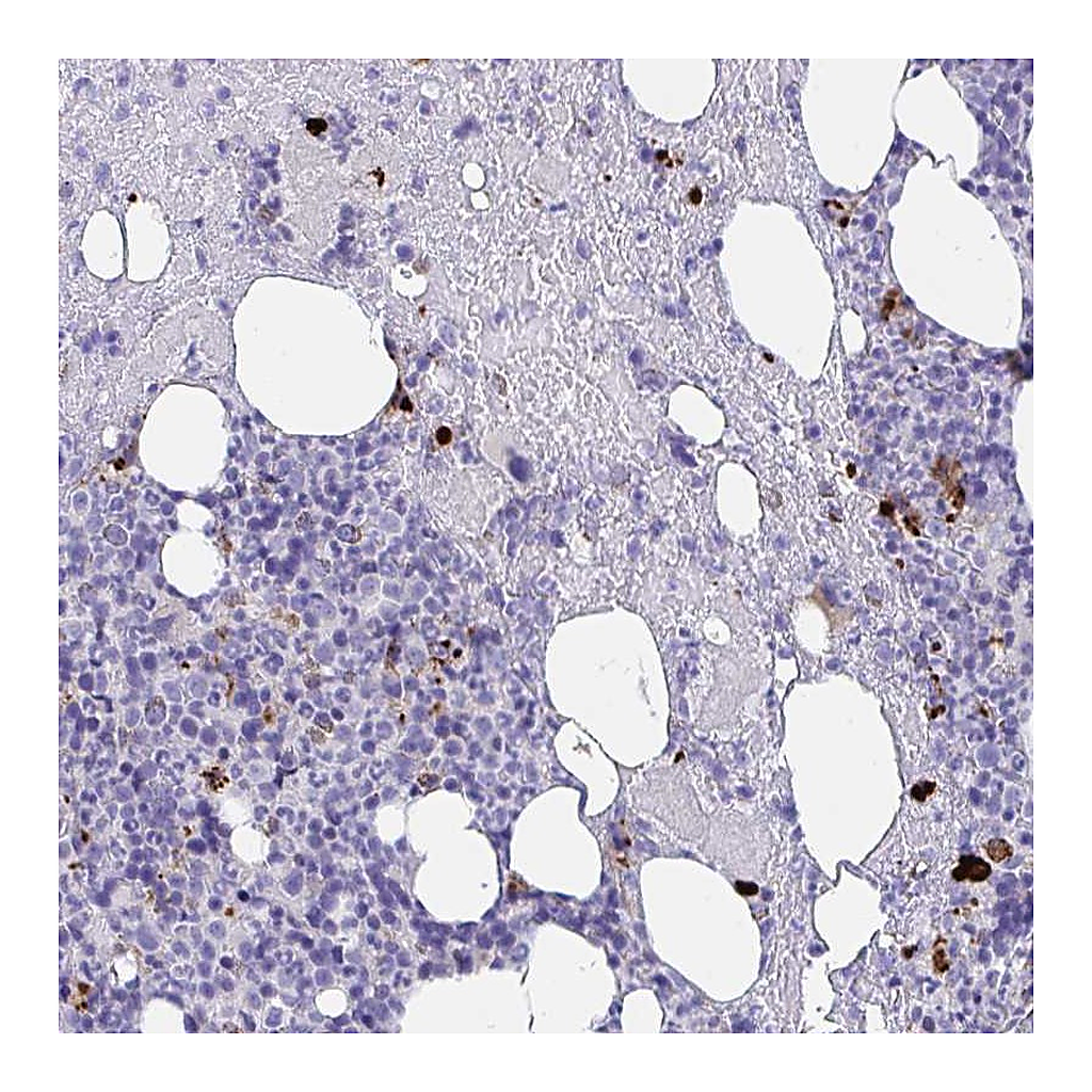 Atlas Antibodies Anti-KMT2E Antibody
