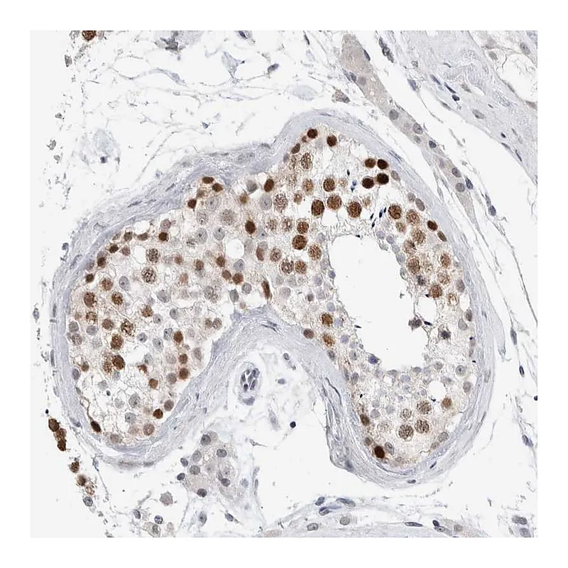 Atlas Antibodies Anti-KNL1 Antibody