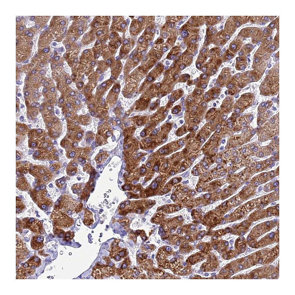 Atlas Antibodies Anti-KNCN Antibody