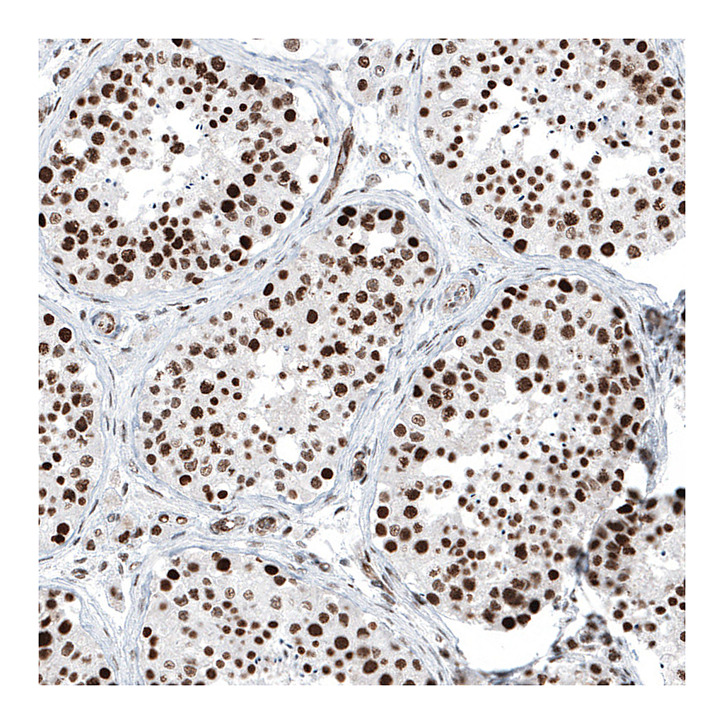 Atlas Antibodies Anti-KMT5C Antibody