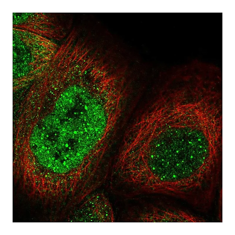 Atlas Antibodies Anti-KNL1 Antibody