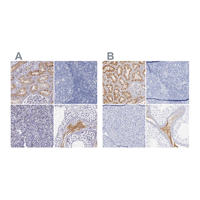 Atlas Antibodies Anti-KNG1 Antibody