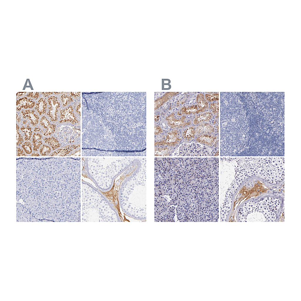 Atlas Antibodies Anti-KNG1 Antibody
